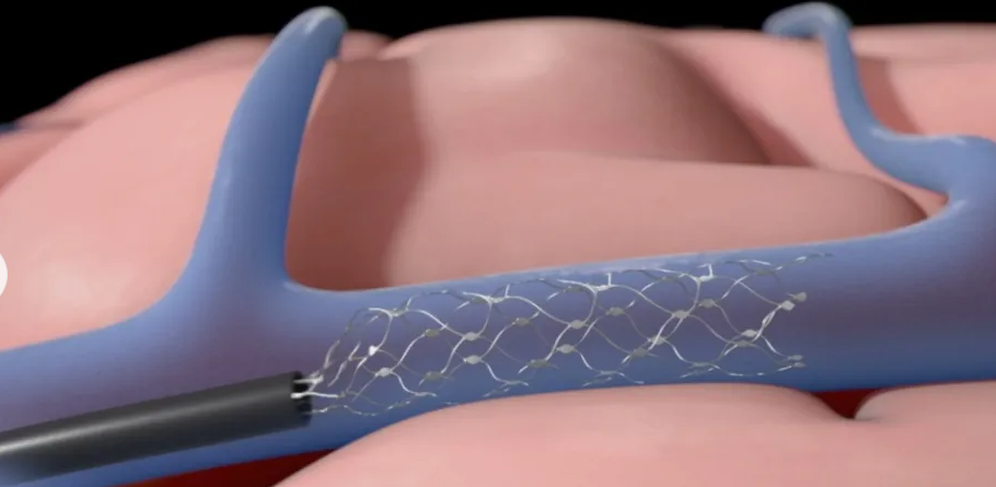 f9c73327553cc983b5232b73f3c4c9f4